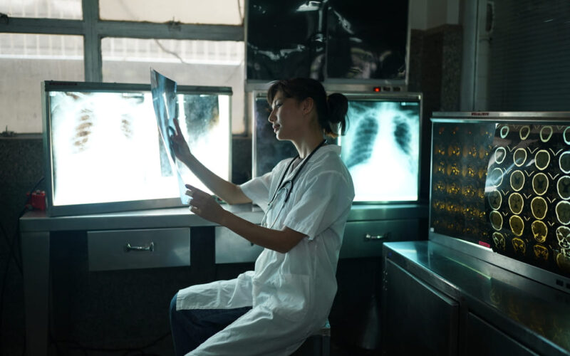 Tratamientos para Duchenne (DMD): opciones disponibles en Guatemala